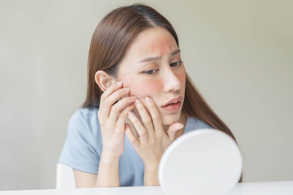 Skin Irritation for using DIY Products